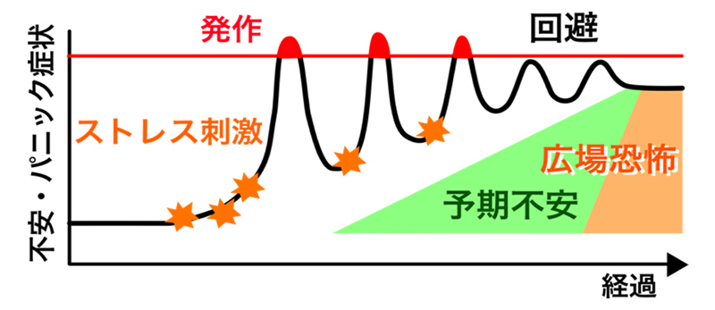 骨盤の統合失調症