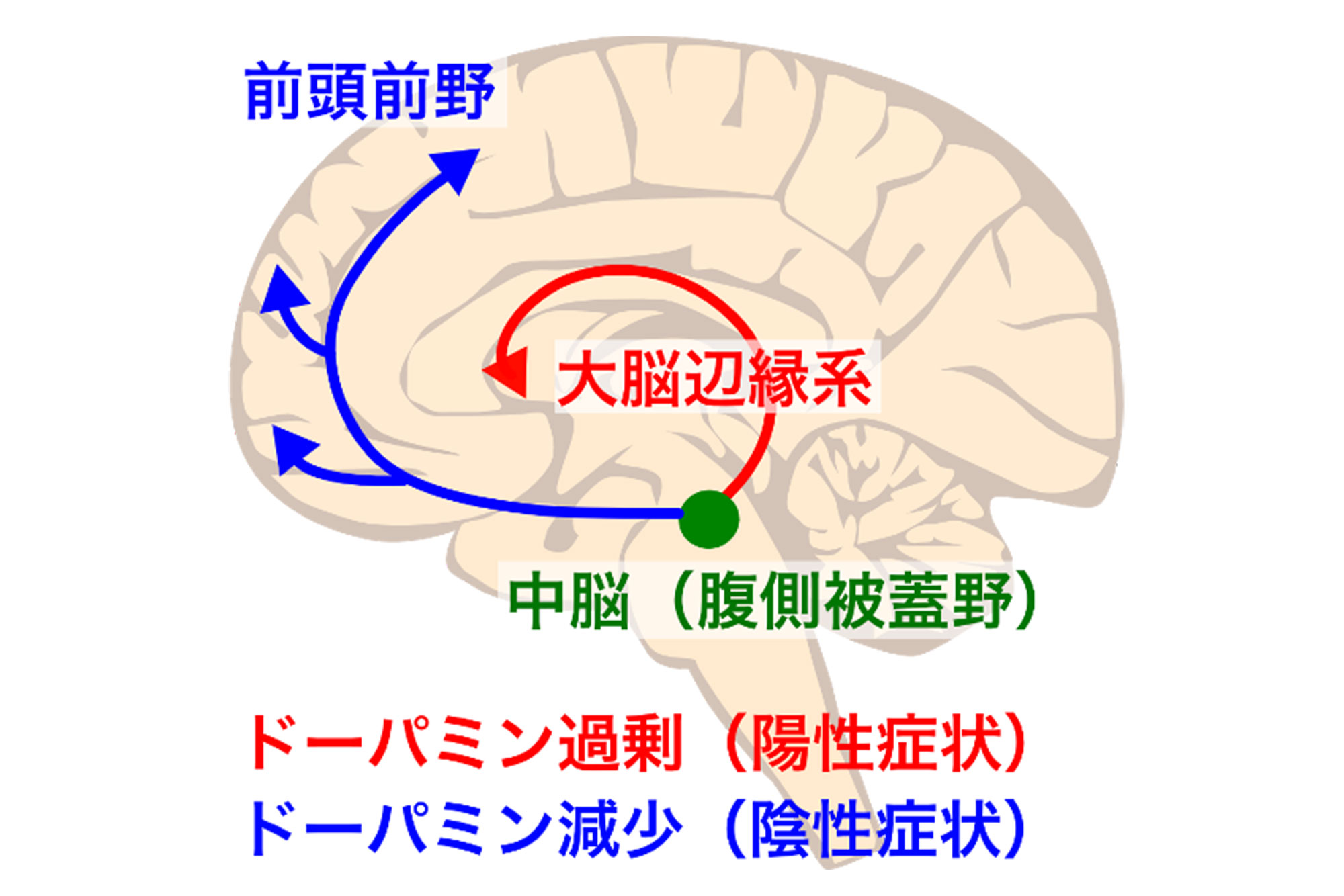 統合失調症におけるドーパミンの役割は何ですか?